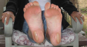 blisteredfeet.jpg